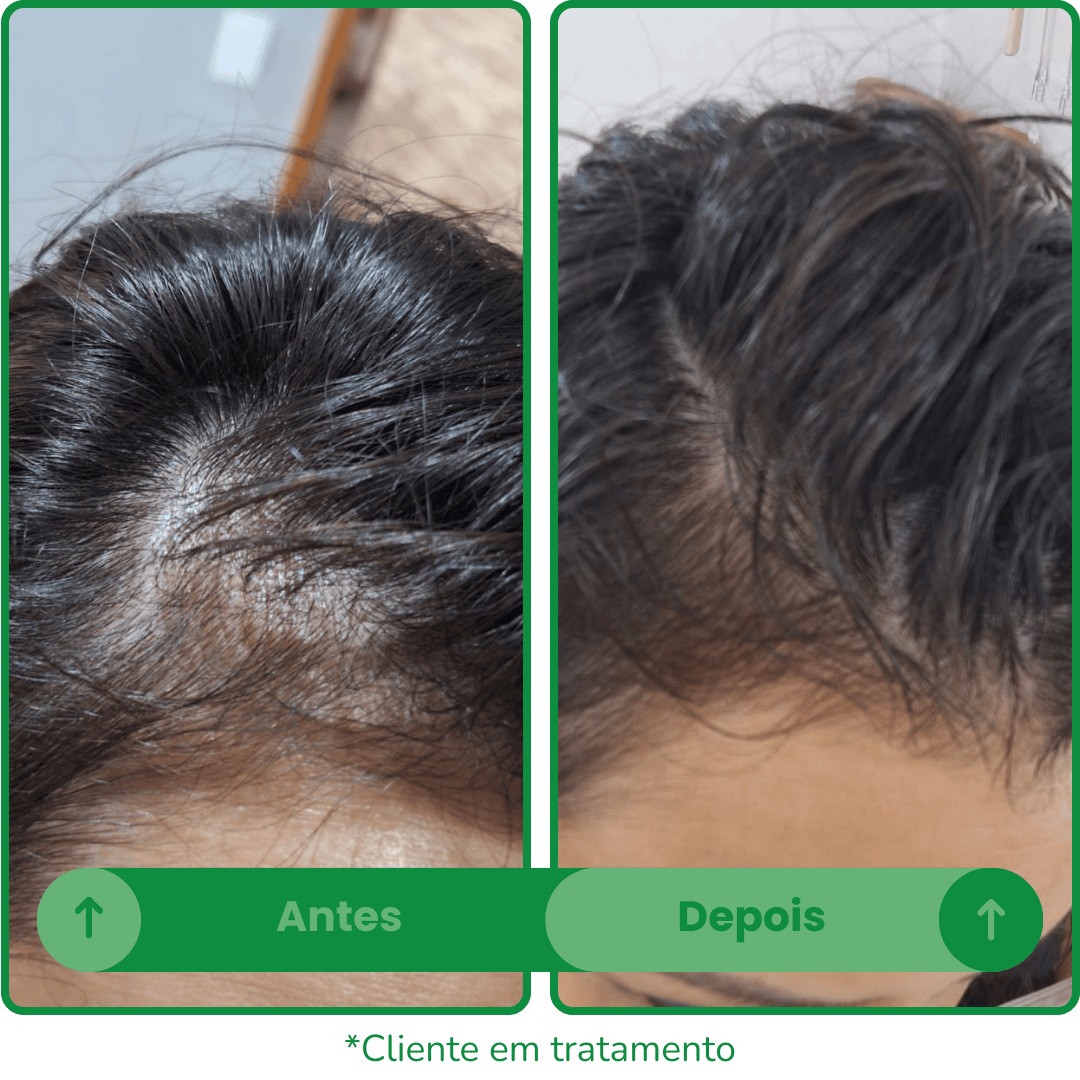 Antes e depois 2